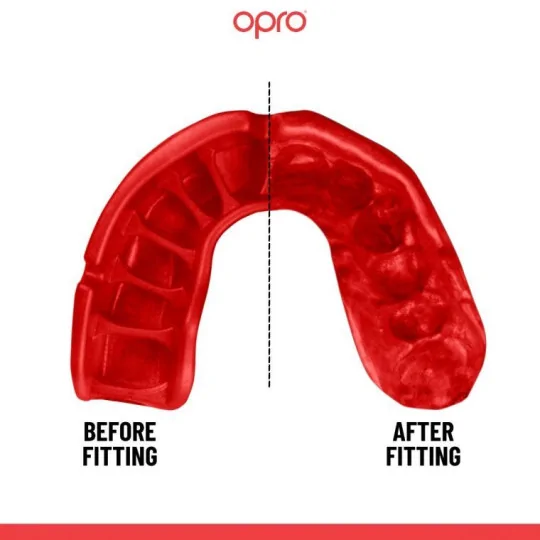 Protezione Paradenti Opro Platinum