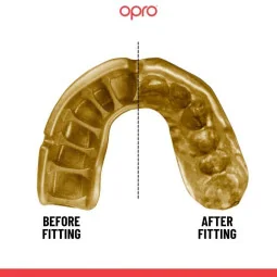 Protezione Paradenti Opro Gold Nero