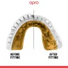 Protezione Paradenti Opro Gold Braces - Nero fumo